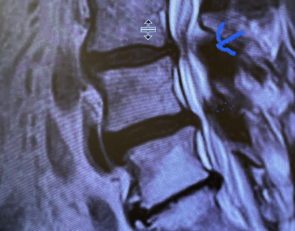figure 2 cysts