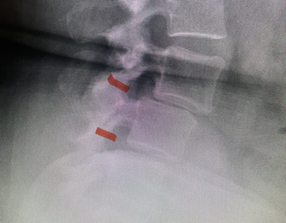 fig 2 (2)