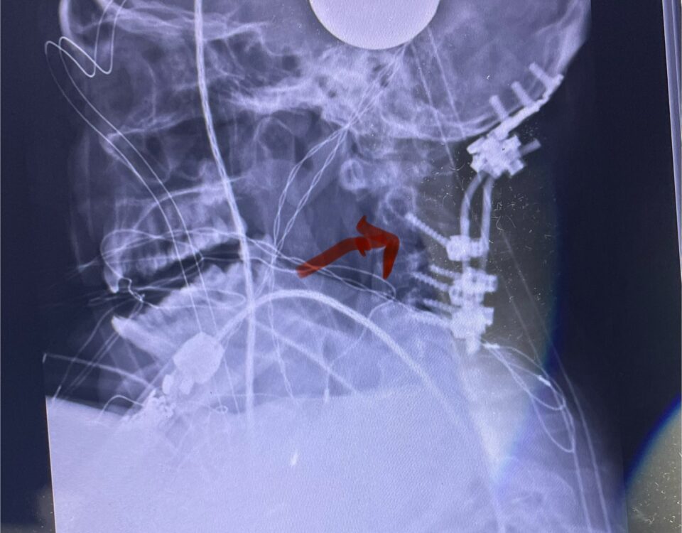 Fig8