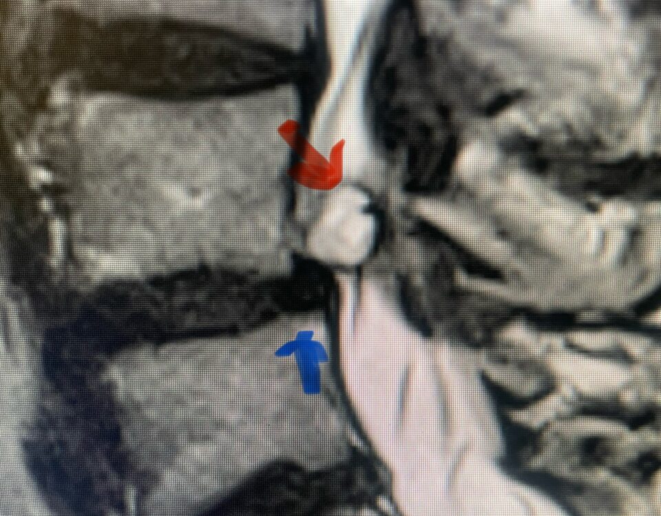 Fig 1a,b
