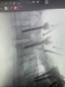Fig 2b