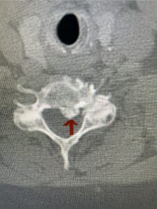 Fig 5b
