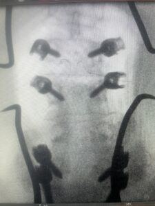 Fig2a
