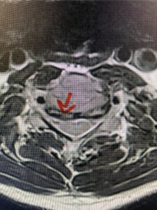 fig 9b